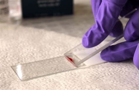 Blood Smear Technique For Veterinarians Department Of Agriculture And