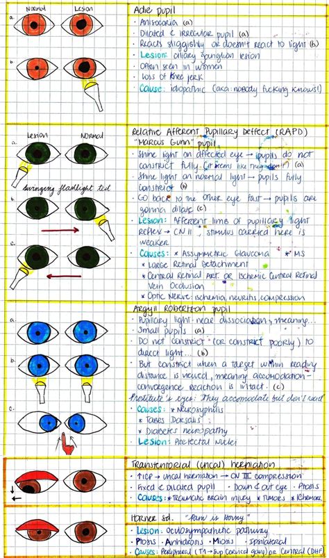 My Notes For Usmle Optometry Education Eye Facts Optometry