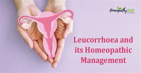 Leucorrhoea In Pregnancy Symptoms Pictures Causes And Treatment With