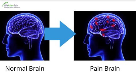 Diagram Diagram Of Brain And Pain Mydiagramonline