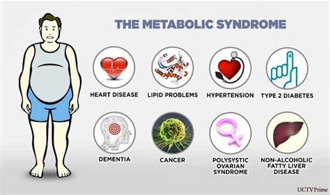 Sindromul Metabolic Sindromul X Endocrinologie Cluj Dr Oana Pinzariu Endocrinologie Cluj