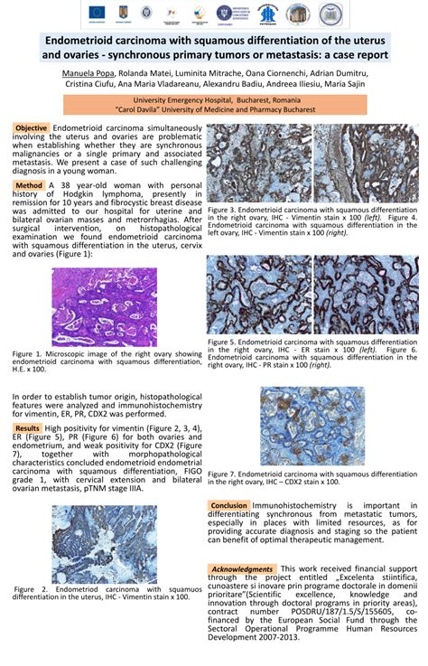 Pdf Endometrioid Carcinoma With Squamous Differentiation Of The