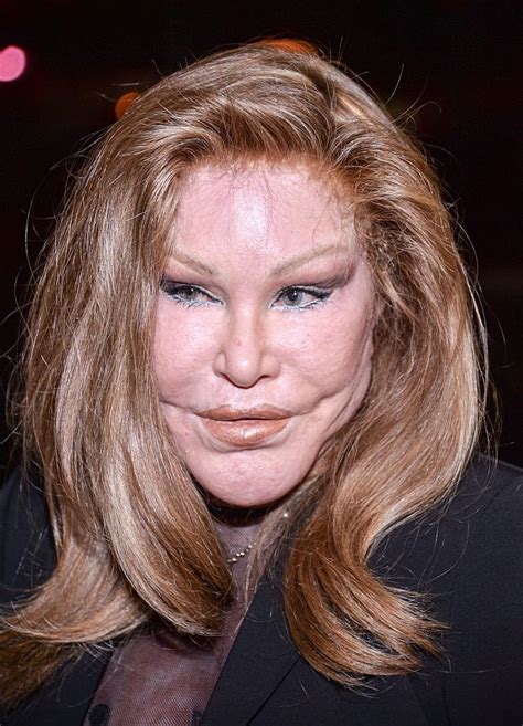 ‘catwoman Jocelyn Wildenstein Denies Cosmetic Surgery Interventions In