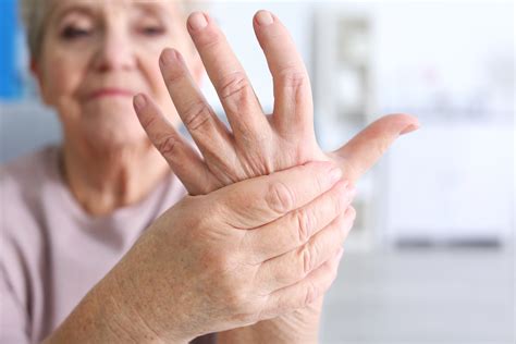 women with rheumatoid arthritis more likely to achieve remission if they take sex hormones scimex