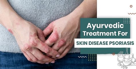 Does Ayurvedic Treatment Work For Skin Disease Psoriasis Shuddhi