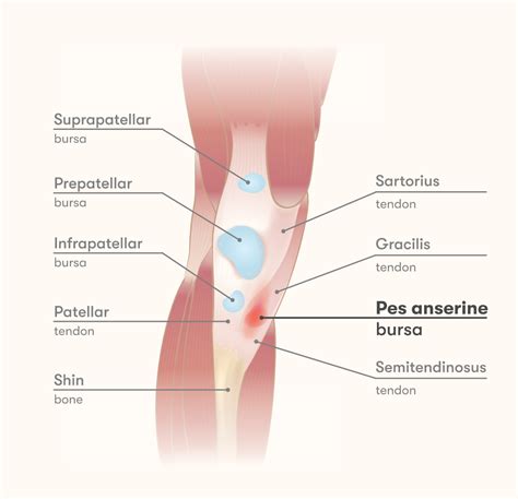Pes Anserine Bursitis Causes Symptoms Treatment Guide
