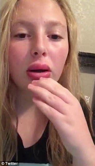 Kylie Jenner Challenge Sees Teens Suck Shot Glasses To Blow Up Their Lips Daily Mail Online