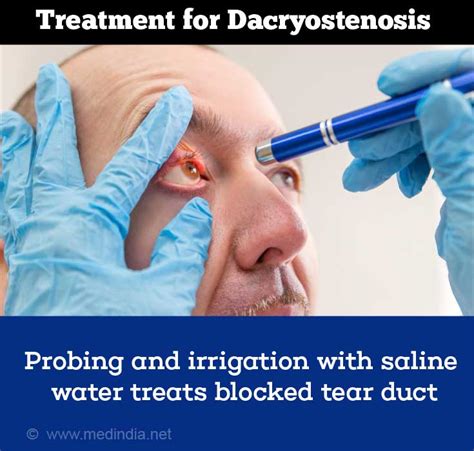 How Can Blocked Tear Duct Be Treated