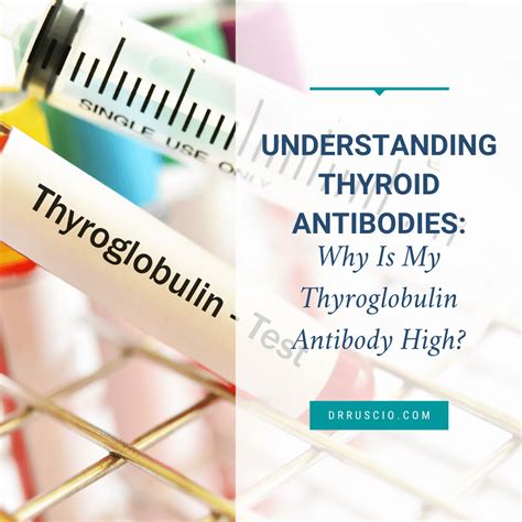 What Are Healthy Levels For Thyroid Antibodies