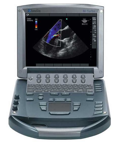 Sonosite M Turbo Portable Ultrasound System Serenity