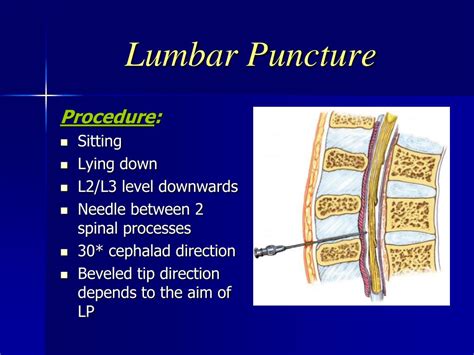 Ppt Lumbar Puncture Powerpoint Presentation Free Download Id6965492