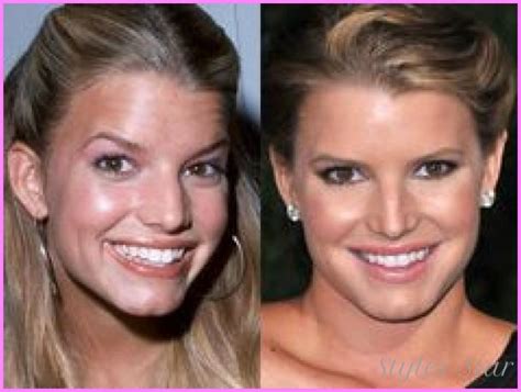 Best Celebrity Smiles Before After Cosmetic Dentistry Images On Pinterest Celebrity