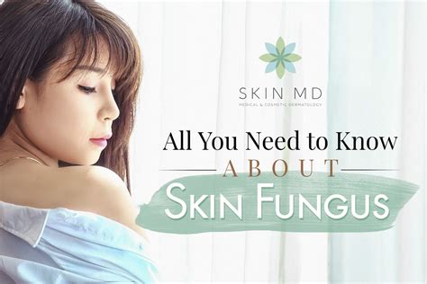 All You Need To Know About Skin Fungus — Skin Md Dermatologist In