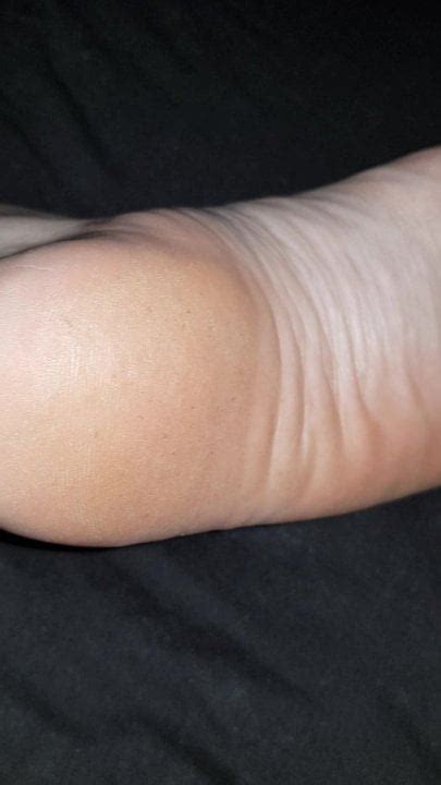 Wrinkled Foot Soles Arches Xhamster