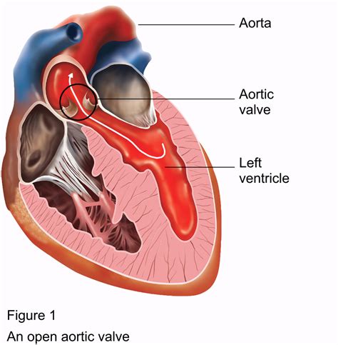 Aortic Valve Replacement Anzscts
