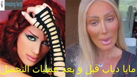 الفنانة مايا دياب قبل وبعد عمليات التجميل ، lebanese actress maya diab after plastic surgery
