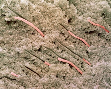 Coloured Sem Of Dentine With Protoplasmic Fibres Photograph By Power