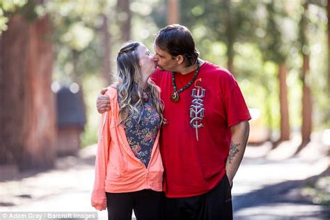California Woman With Craniofacial Disorder Embraces Look Daily Mail Online