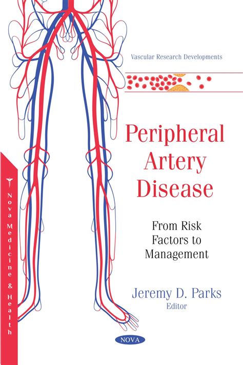 Peripheral Artery Disease From Risk Factors To Management Nova
