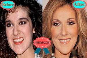 Celine Dion Plastic Surgery Celine Dion Teeth And Nose Job Top Piercings