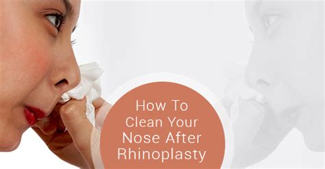 4 Ways To Clean Your Nose After Rhinoplasty Dr Oakley Smith