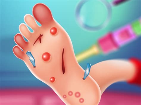 Foot Doctor Game Play Foot Doctor Online For Free At Yaksgames