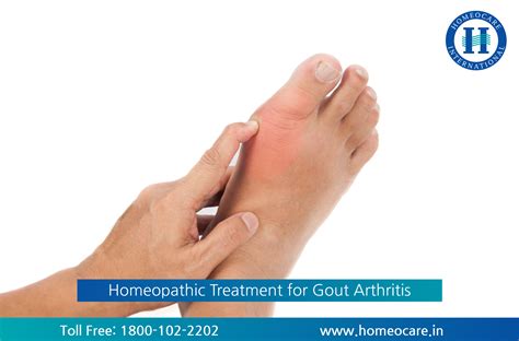 Facts Everyone Should Know About Homeopathy Treatment For Gout