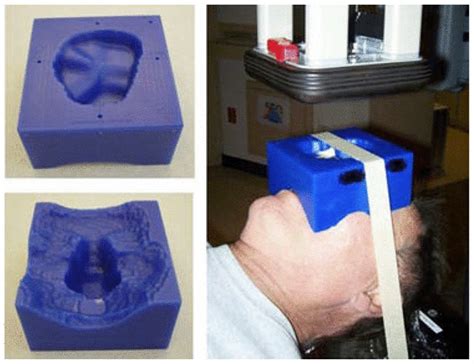 3d Printed Bolus Protects Cancer Patients During Radiation Therapy May