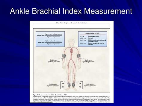 Ankle Brachial Index
