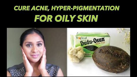 How To Cure Acne And Fade Blemishes African Black Soap