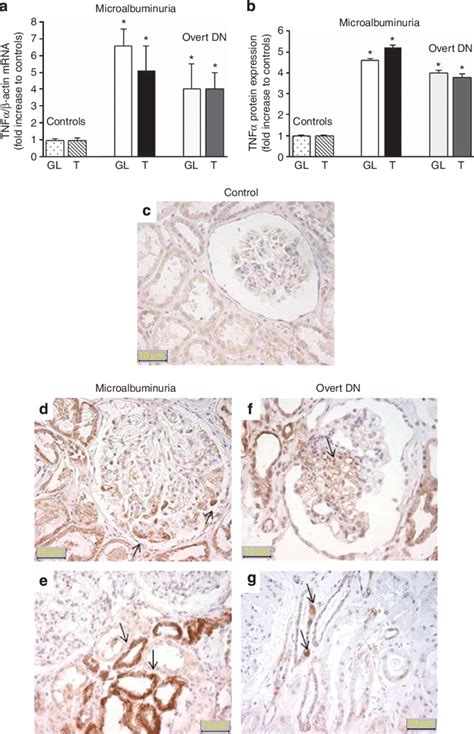 Expression Of Tumor Necrosis Factor A Tnf A Mrna And Protein In