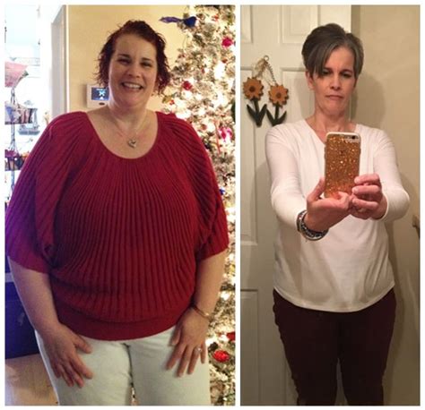 Cheryl Loses 98lbs High Bp And Cholesterol After Weight