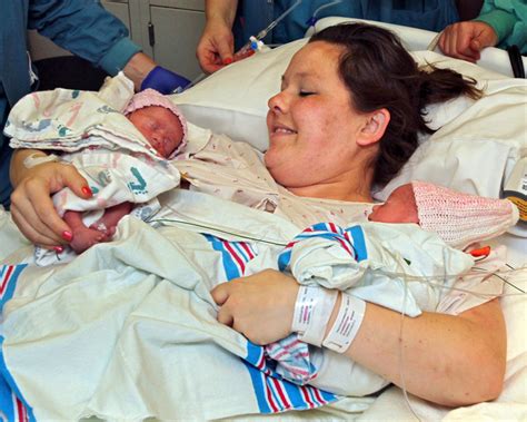 rare ‘mono mono newborn twins born holding hands national globalnews ca
