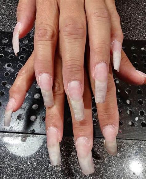 Facebook Users Horrified By Womans ‘nasty Nails Can You See Why