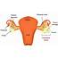 Disease Graphics Videos & Images On Ovarian Cancer