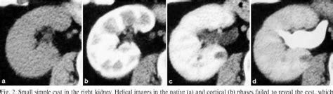 Figure 2 From Detection And Characterisation Of Renal Lesions By