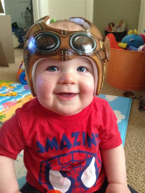 Amazingly Creative Helmets For Babies With Plagiocephaly Baby Helmet
