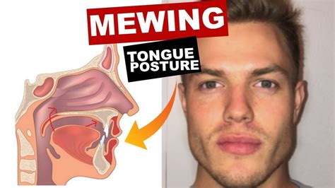 Mewing Tongue Posture Train Your Tongue To Attach To Your Mouth Youtube