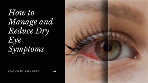 How To Manage And Reduce Dry Eye Symptoms Chronicleslive