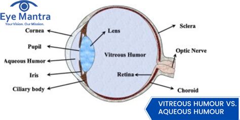 What Is A Vitreous Humor Sample