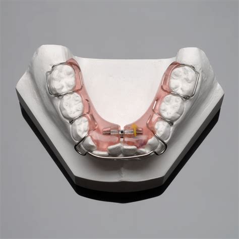 Aparelho Expansor Infantil Inferior