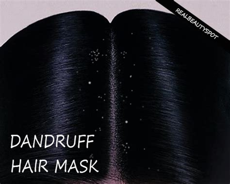 Make sure to talk to a dermatologist for best advice. Natural dandruff treatment with hair masks | THE INDIAN SPOT