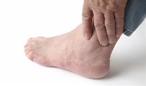 Arthritis Of The Feet And Ankles What You Need To Know — Westfield