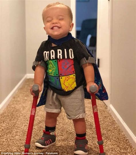 Two Year Old With Spina Bifida Uses Crutches While Proudly Sharing His