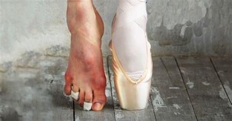 Professional Ballet Ruined My Mental Health Girlsaskguys
