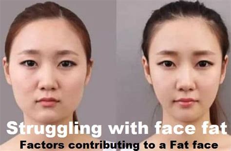 Not losing face fat reddit. Losing Face Fat / Fat Loss Facelift Revere Clinics / Losing face fat might not be as ...