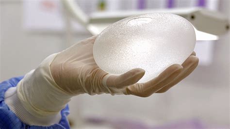 Health Canada Finds Low Number Of Rare Cancer Cases Linked To Breast Implants Health Cbc News