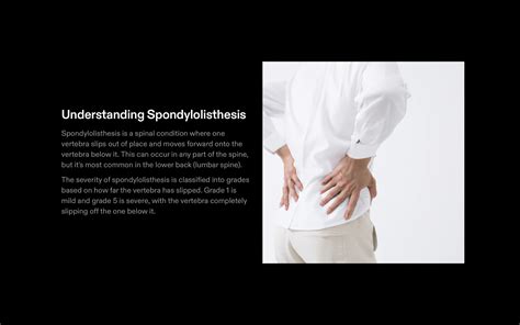Spondylolisthesis Types Causes Symptoms Treatments Exercises And