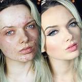 Photos of Face Cream Before Makeup