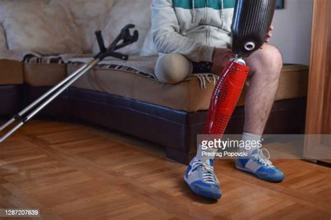 Amputee Crutches Photos And Premium High Res Pictures Getty Images